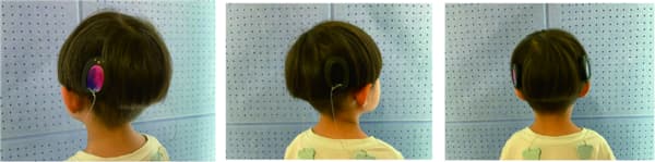 Correct wearing of hearing aid cochlear